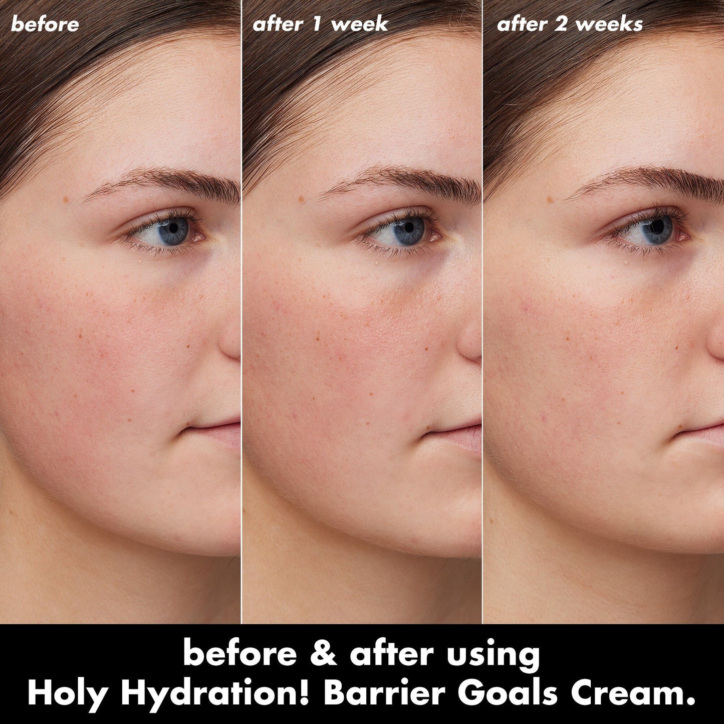 holy-hydration-barrier-goals-cream-v3 0226_EDU_HHBarrierGoalsCream_B_A_Zoe_TRYPTICH_710f5249-3a6b-41fd-89e4-817294dd9258.jpg