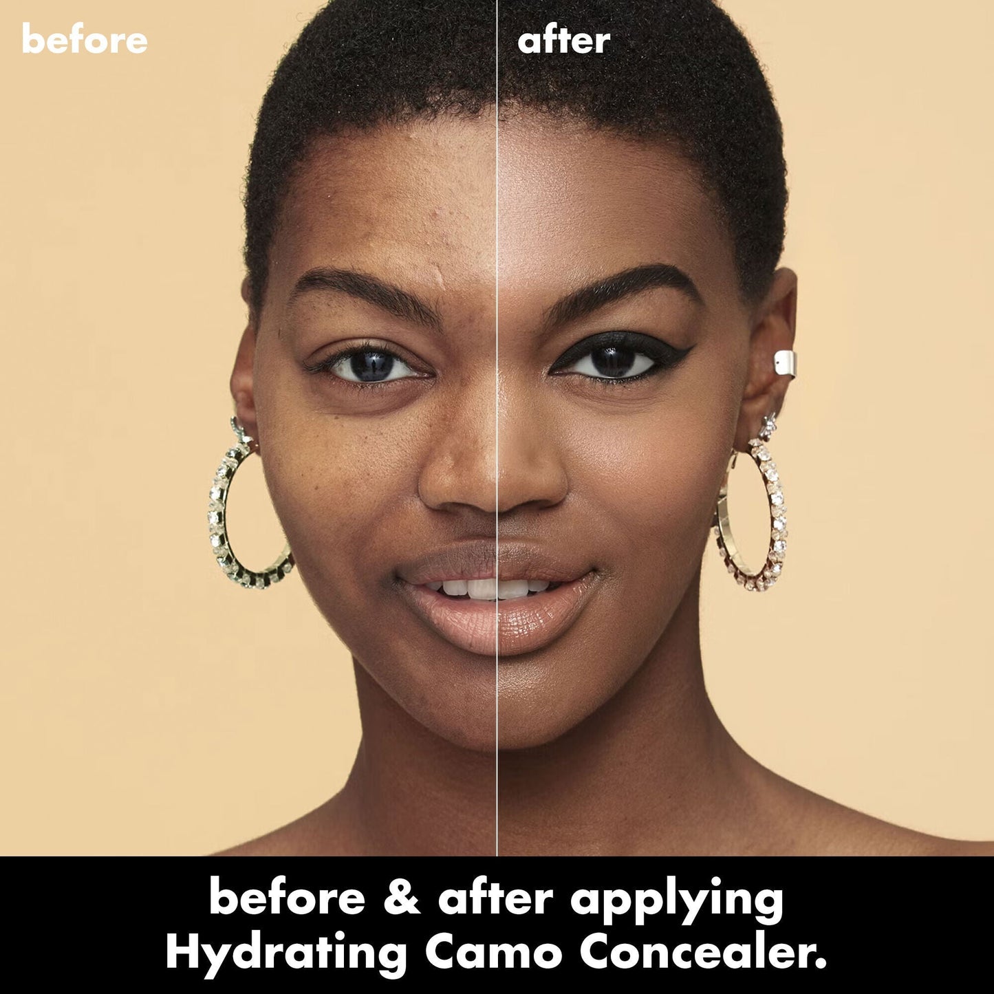 hydrating-camo-concealer-l9 0226_EDU_HydratingCamoConcelaer_BA_AshleyKaresh_20_1_d8499bbf-0e91-4173-b5e2-75127caf83a3.jpg