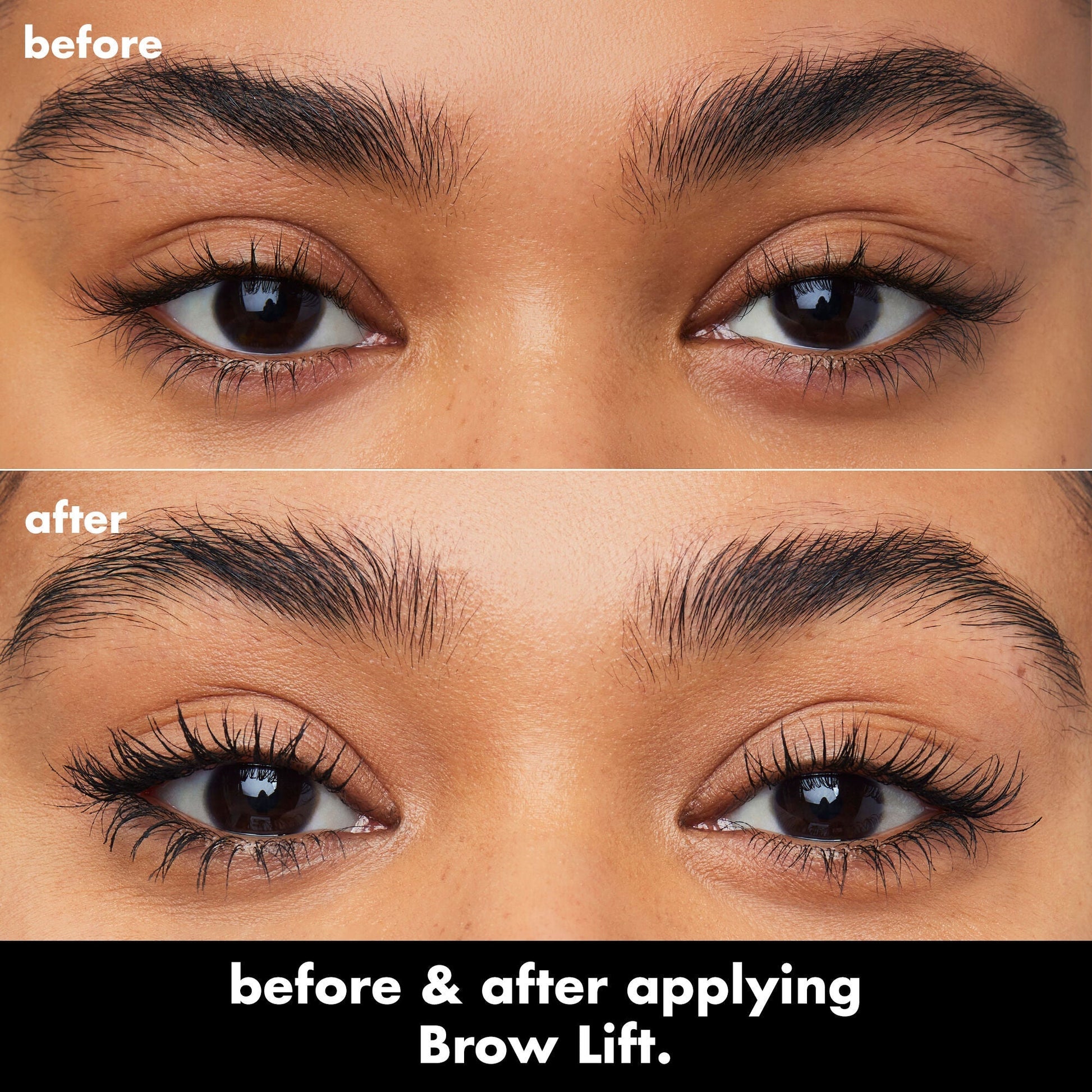 brow-lift-c9 0326_EDU_BrowLift_BA.jpg