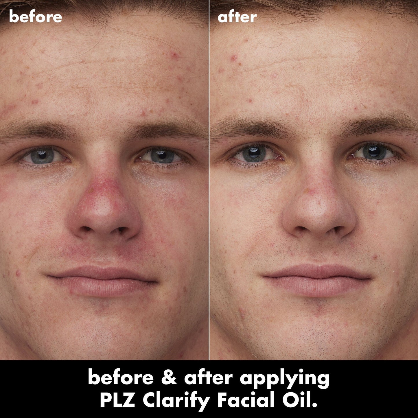 plz-clarify-facial-oil-e4 0326_EDU_PlzClarify_BA_Caleb.jpg