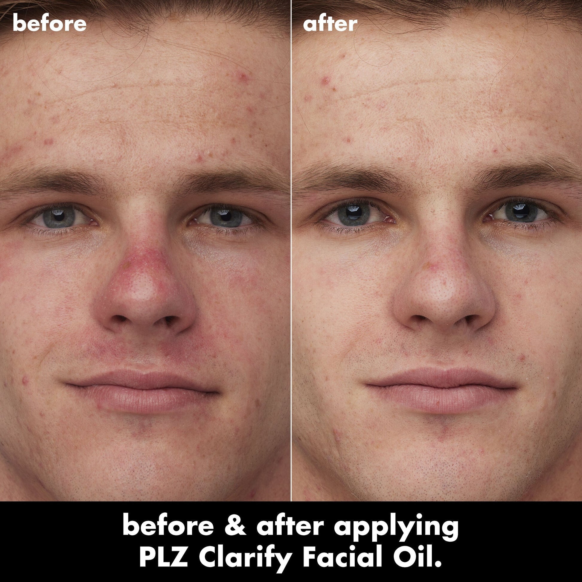 plz-clarify-facial-oil-e4 0326_EDU_PlzClarify_BA_Caleb.jpg