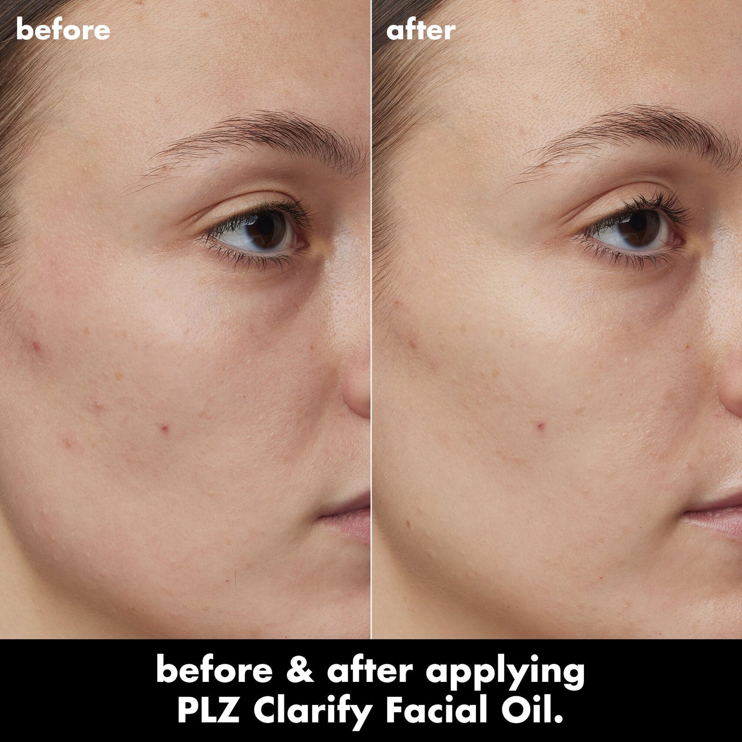 plz-clarify-facial-oil-e4 0326_EDU_PlzClarify_BA_Kelly.jpg