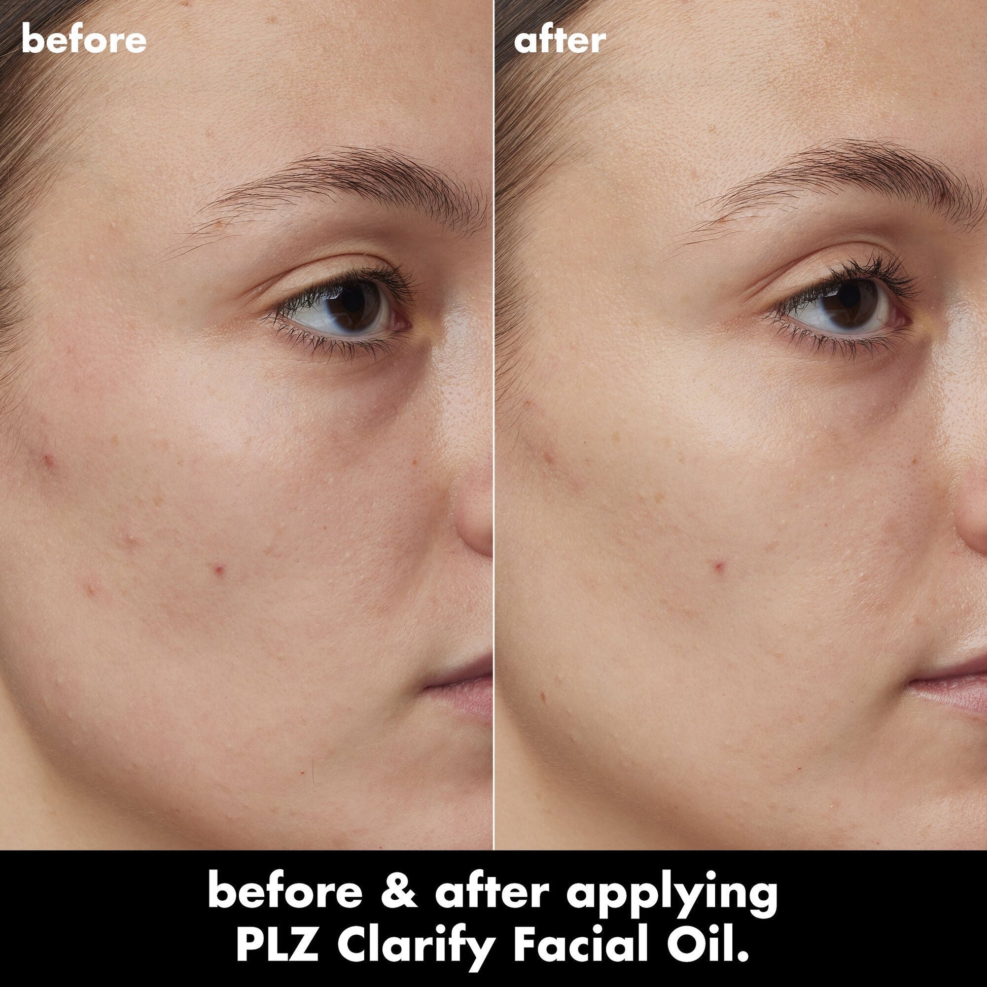 plz-clarify-facial-oil-e4 0326_EDU_PlzClarify_BA_Kelly.jpg