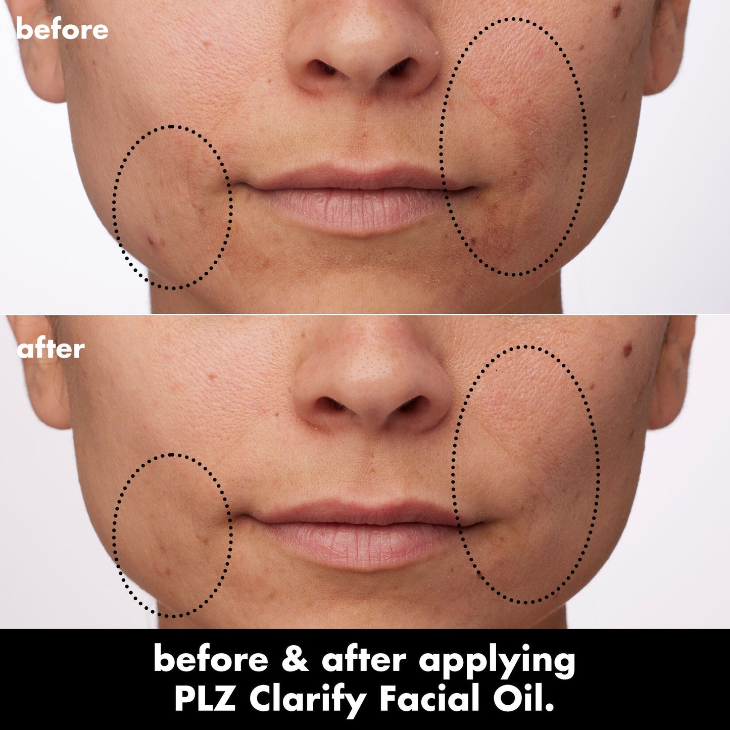 plz-clarify-facial-oil-e4 0326_EDU_PlzClarify_BA_Paula.jpg