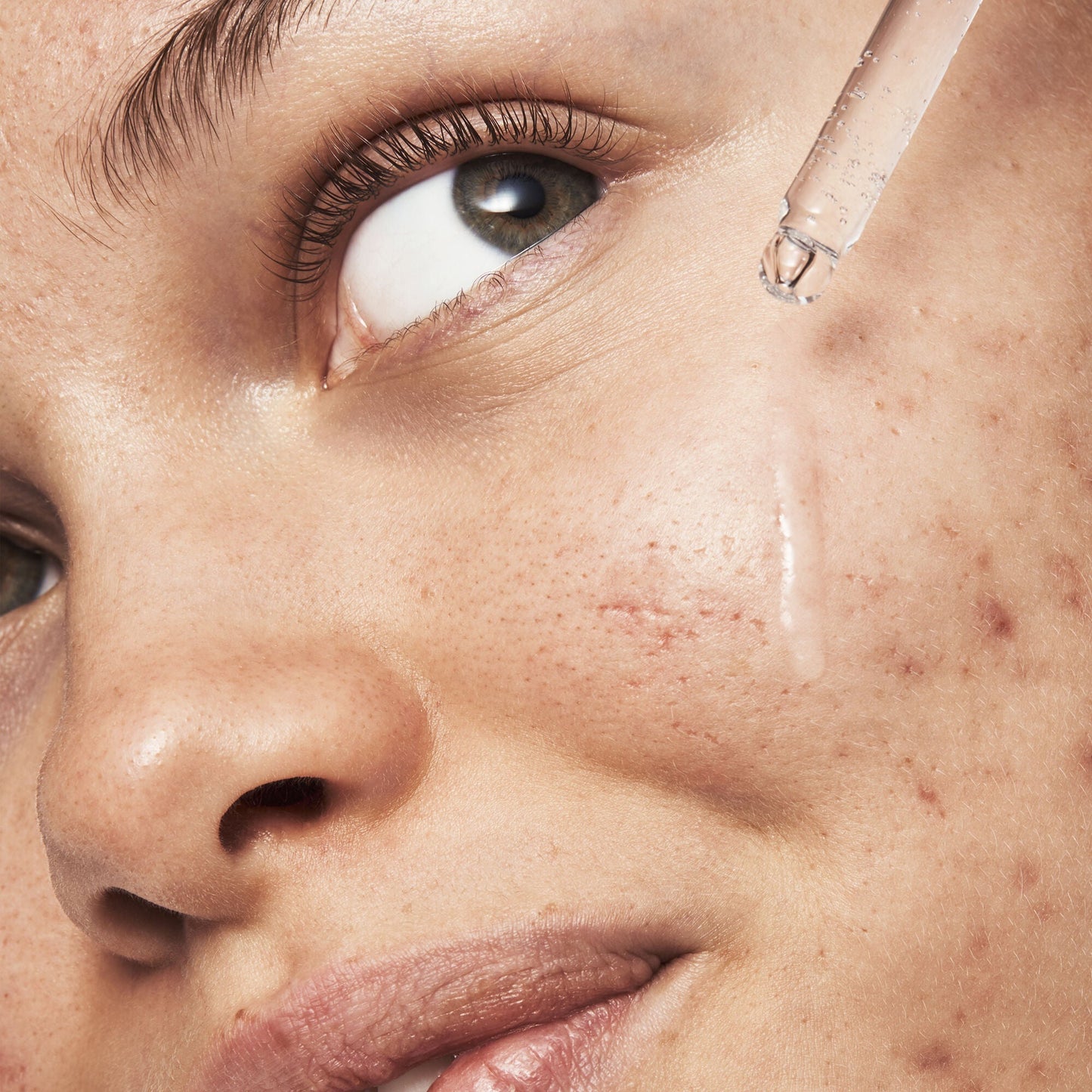 blemish-breakthrough-triple-acid-resurfacing-serum-x8 121321_Marley-Acne-Regimen_0254_FINAL_IGF.jpg