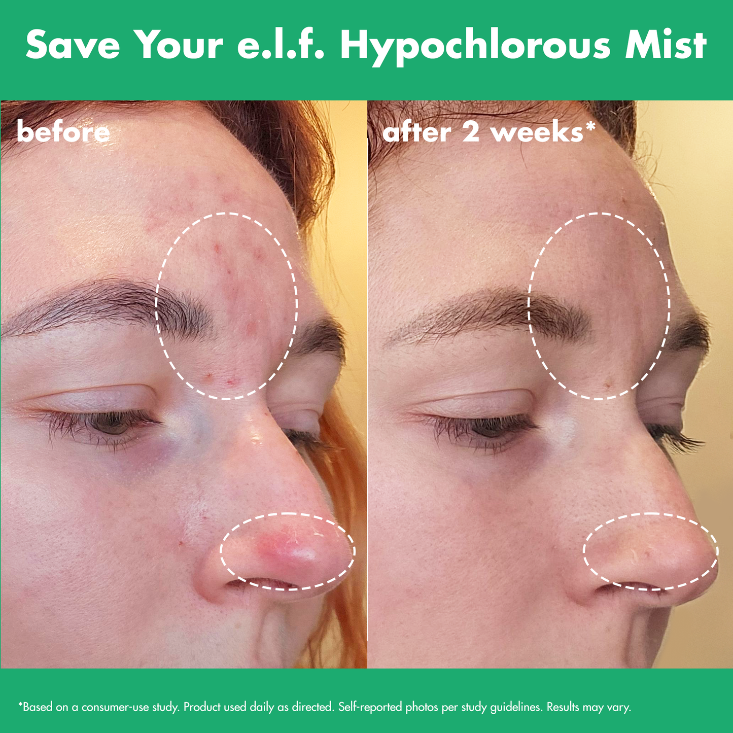 save-your-e-l-f-hypochlorous-mist-a9 FA26_EDUCATION_SAVEYOURELF_USAGE_BA1_WITHOUT_CLAIMS.png