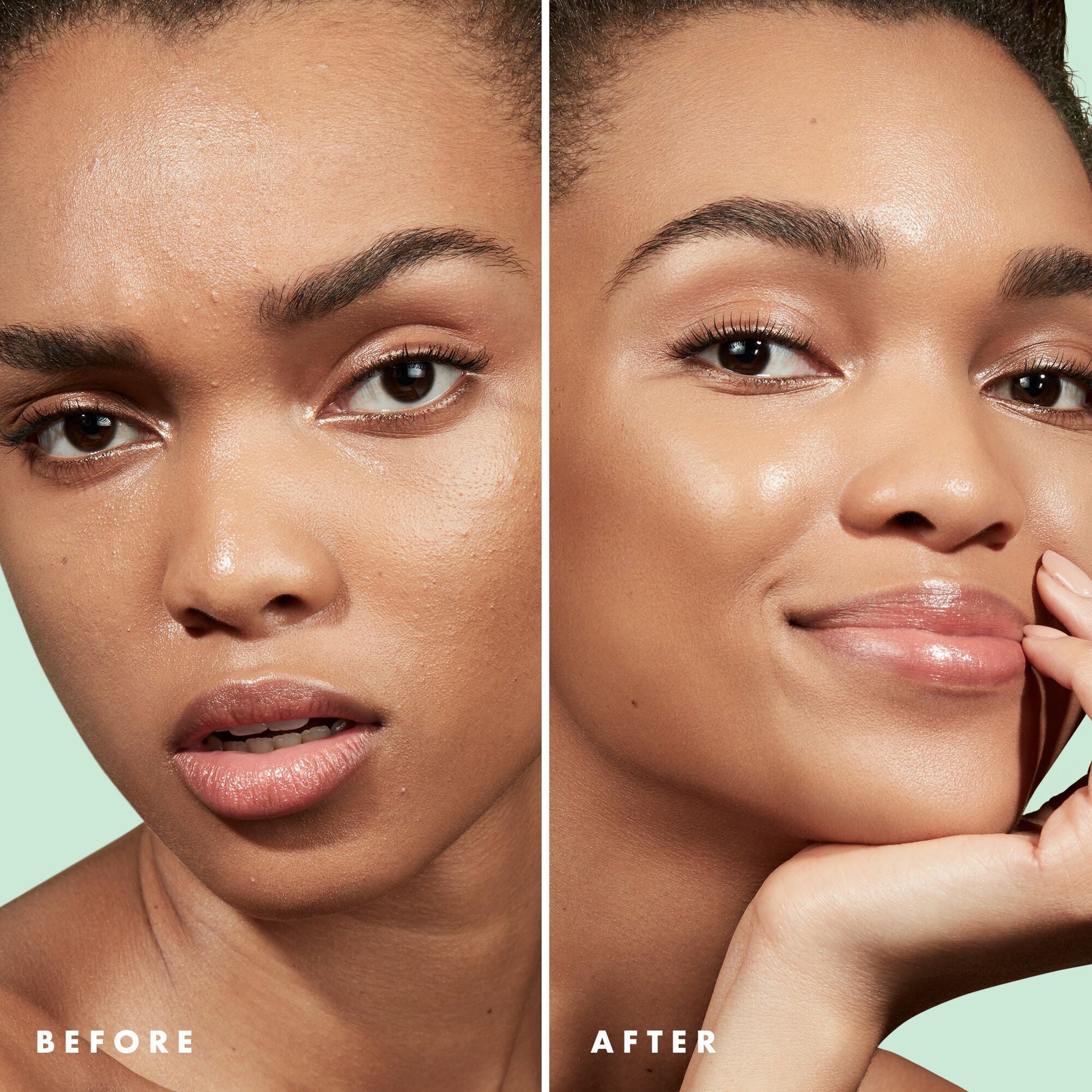 blemish-control-face-primer-small-size-w8 Primer_PP_Before_After_BlemishControl_2000x2000_1b657297-1b62-4427-874a-10c706535581.jpg