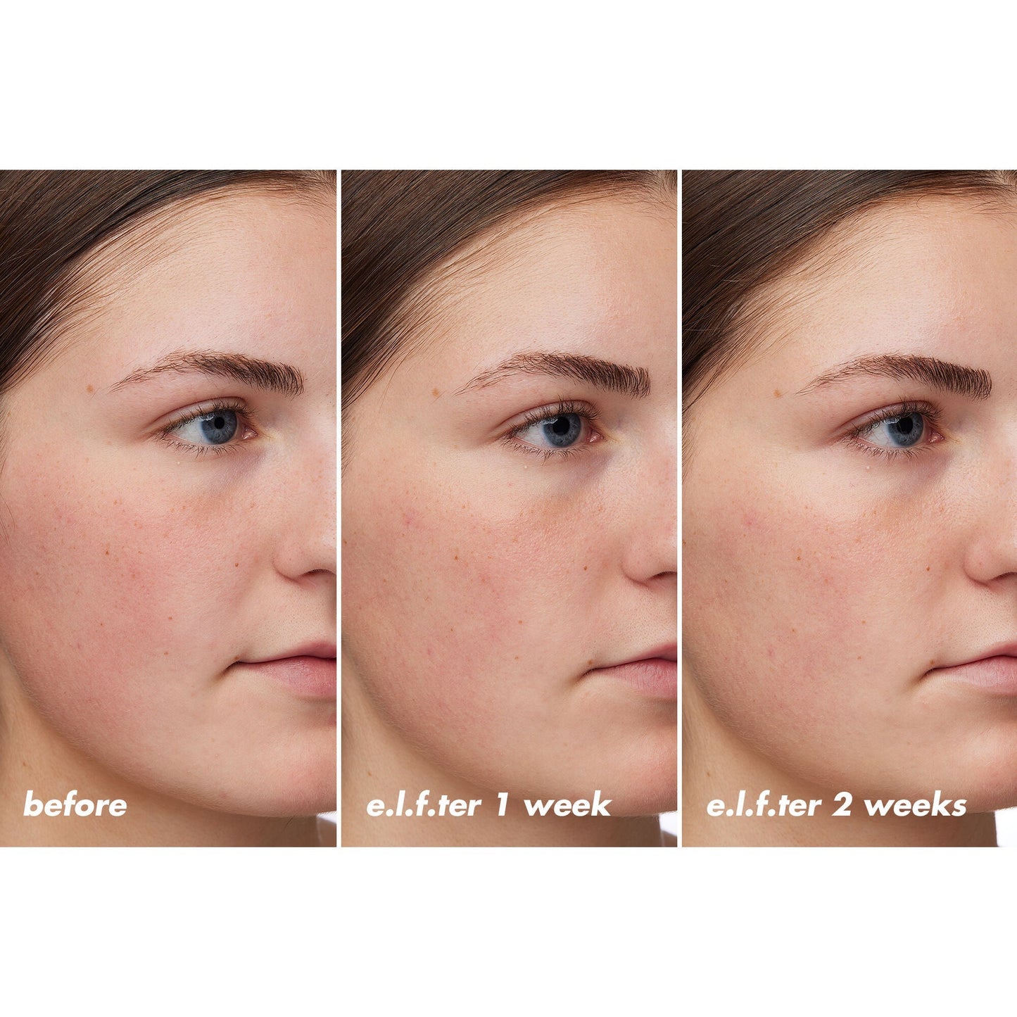 holy-hydration-barrier-goals-cream-regular-w0 XX26_EDUCATION_HH-BarrierGoals_B_A_Zoe_TRYPTICH_74c905bd-67bd-4b91-b633-2b01a8905cb8.jpg